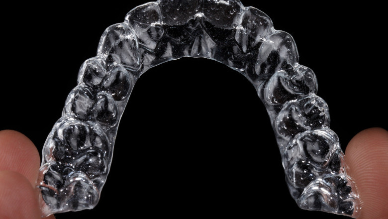 How to Clean Invisalign Braces: These Steps