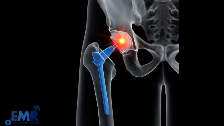 Orthopaedic Biomaterials Market Analysis, Outlook, Report, Size, Share, Price, Trends, Growth, Forecast 2021–2026