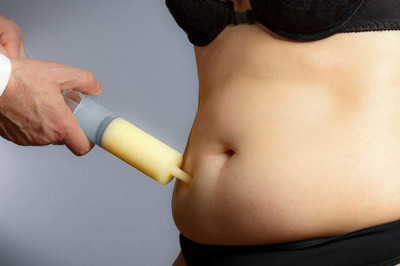 The Best Liposuction services in Mohali, India | Skin & Sculpt