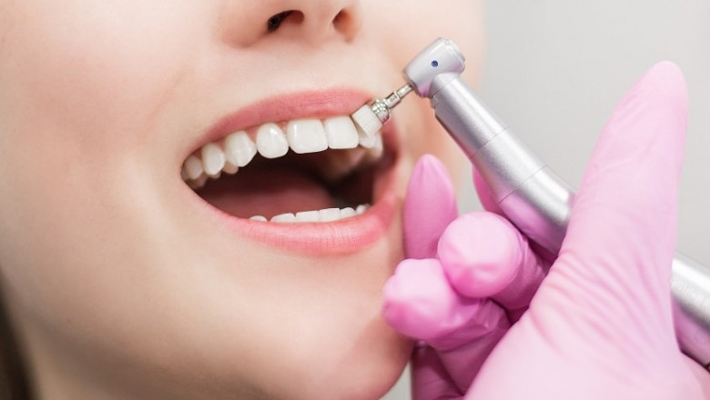 Dental Surgery Services Provided By Affordable Austin TX Dentist