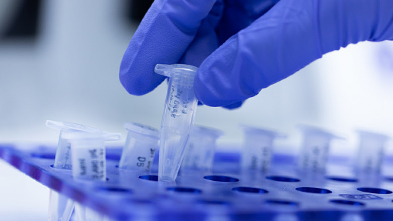 Organ Preservation Solutions Market : Business Overview and Global Development Trends