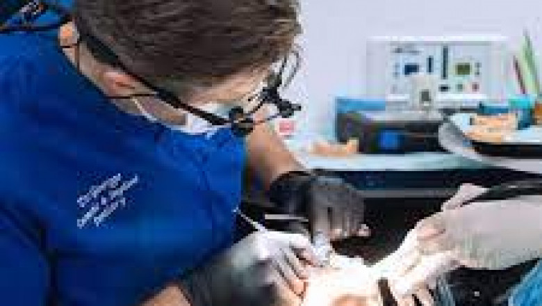 All On 4 Implants Sunny Isles