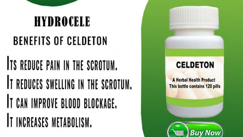 Natural Treatment for Hydrocele with Herbal Supplements