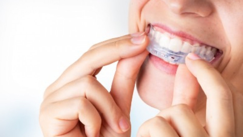 Benefits of Dental Crowns That Will Make You Smile More