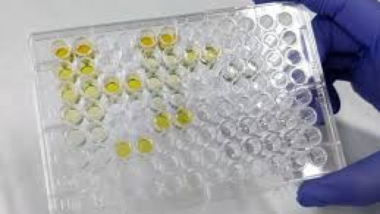 Global Alkaline Phosphatase Kits Market 2022 - Top Key Players Analysis Report Till 2028