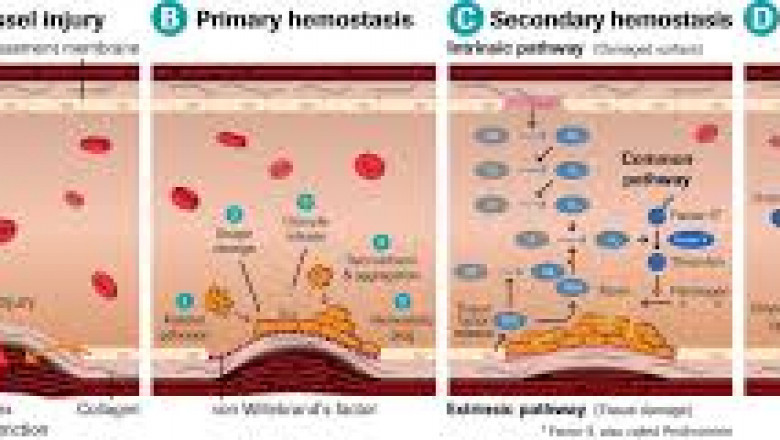 Thrombophilia Testing Market Size, In-depth Analysis Report and Global Forecast to 2028