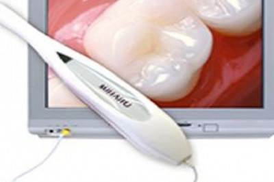 What is the Main Type of Dental Implant?