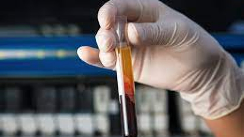 Prothrombin Time Testing Market Size, Share, Growth, Opportunities and Global Forecast to 2028