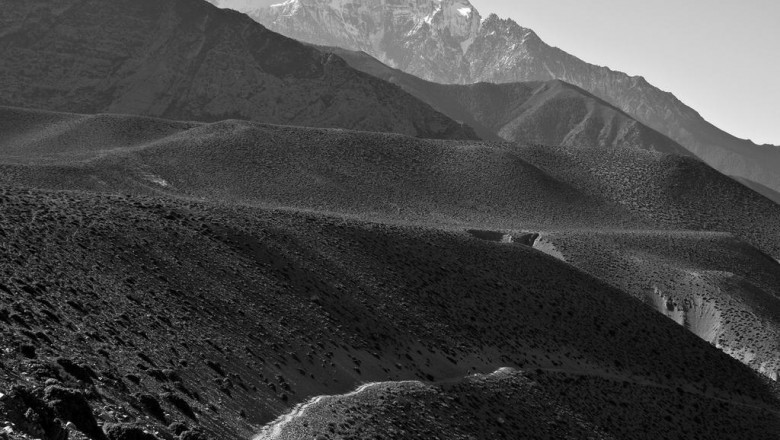 invisalign tandreglering orthodontist london ontario