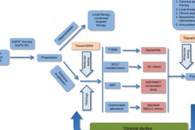 EGFR-TKI for Advanced NSCLC Market | Global Opportunity, Growth Analysis And Outlook Report upto 2027