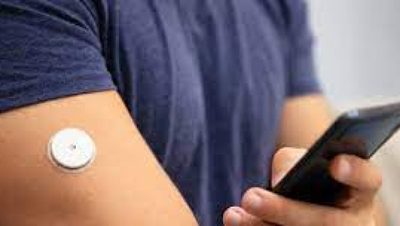 Glucose Monitor Device Market 2022 | Industry Demand, Fastest Growth, Opportunities Analysis and Forecast To 2028