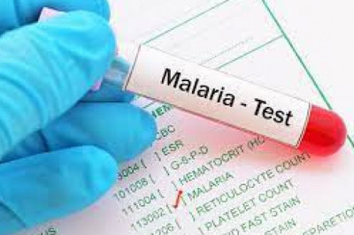 Malaria Diagnostics Market 2022 Key Players, Share & Forecast Report to 2028
