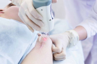 When Selecting A Post-Surgical Scar Treatment Product