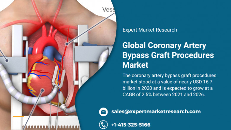 Global Coronary Artery Bypass Graft Procedures Market To Be Driven By The Increasing Prevalence Of Multiple Cardiovascular Disorders In The Forecast Period Of 2021-2026