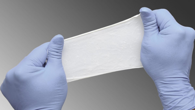Global Soft Tissue Repair Market: Trends, Size, Share, Growth, Opportunities, and Forecasts