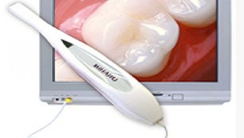 What Are The Four Alternatives to Veneers?