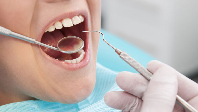 Why Do Dentists Use Dental Crowns?
