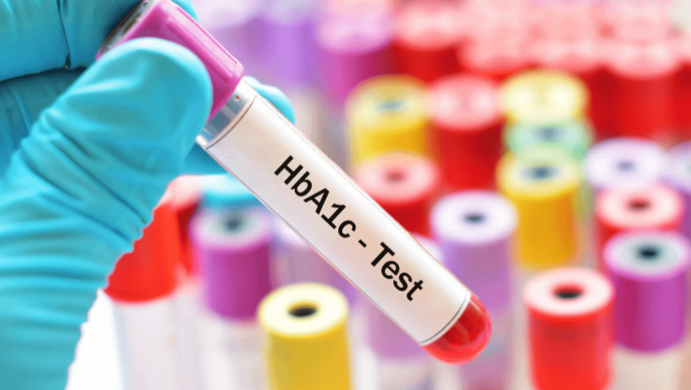 Global HbA1c Testing Market Size, Share, Latest Trades and Growth Analysis Report Till 2028