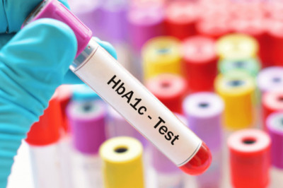 Global HbA1c Testing Market Size, Share, Latest Trades and Growth Analysis Report Till 2028