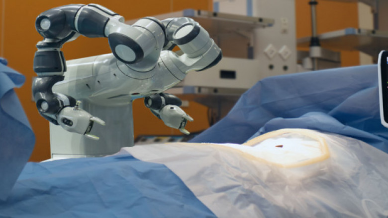 Healthcare Robotics Market Insight | Outlook | Growth Analysis Report 2022-2028