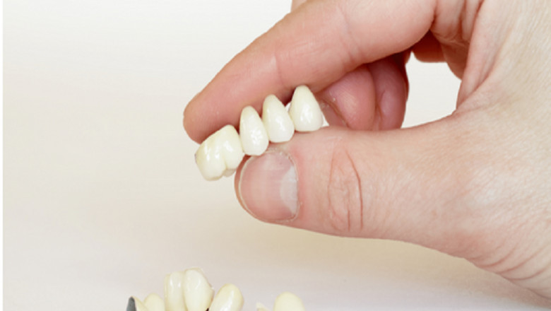 Select Perfect Dental Practitioner for Your Household