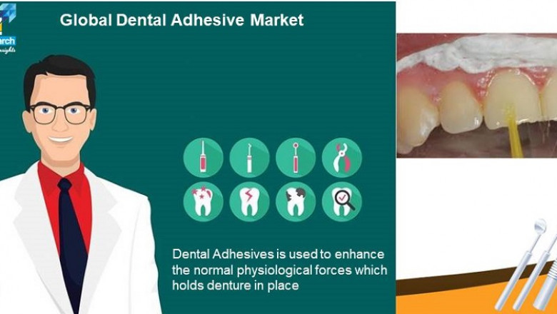 Global Dental Adhesive Market Trends Analysis and Industry Forecast 2027 | VynZ Research
