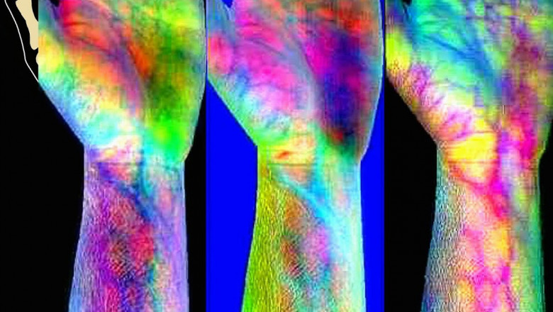 Global Hyperspectral Imaging Market Overview