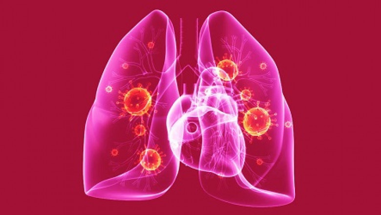 There is one strain of bacterium most commonly found in Pneumonia Testing, Streptococcus Pneumonia Testing.
