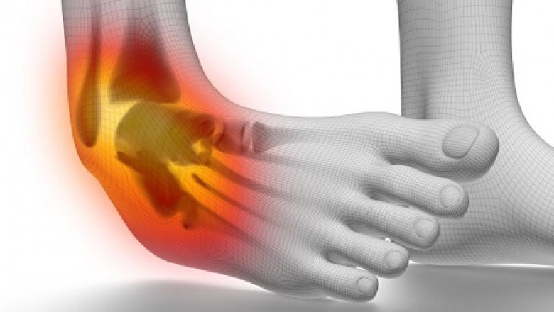 A Look at Various Benefits of Physiotherapy!