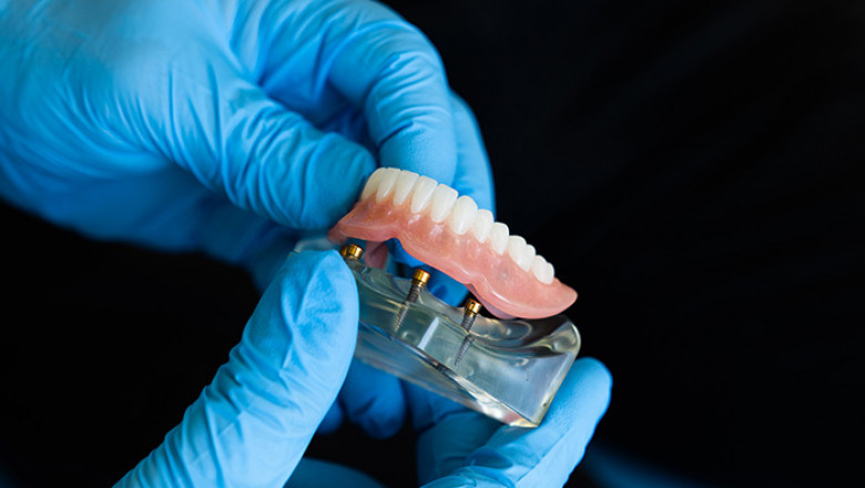 What’s Involved in Getting New Dentures?