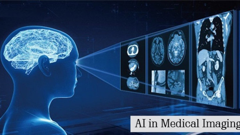 Artificial Intelligence in Medical Imaging Market 2022 Size, Growth Factors & Forecast Report to 2028