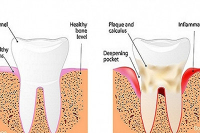 What Common problems can occur after dental implant surgery?