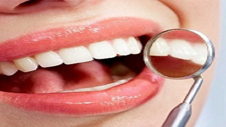 Why Do Dentists Recommend Wisdom Tooth Removal?