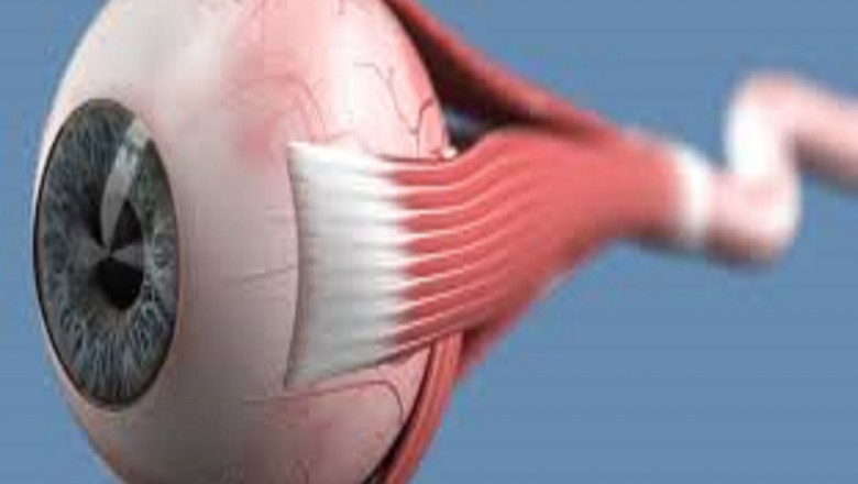 Global Optic Neuritis Treatment Market Report, Latest Trends, Industry Opportunity &amp; Forecast to 2028