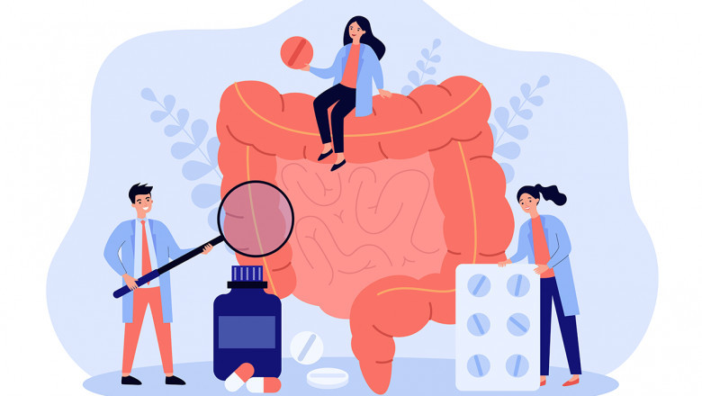 Global Colorectal Cancer Therapeutic Market Report, Latest Trends, Industry Opportunity &amp; Forecast to 2028