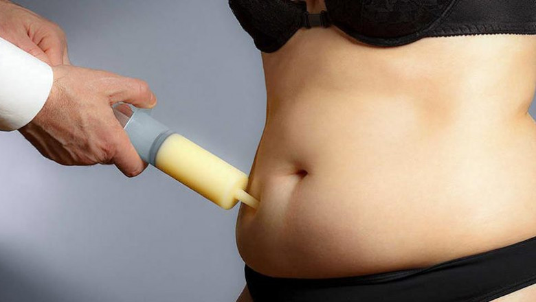Looking for the best liposuction in Chandigarh at reasonable price