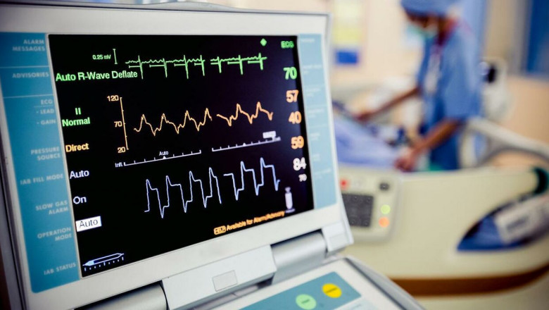The ECG Management Systems Automates Procedures, Stores Data, And Displays ECGs To Improve Patient Care