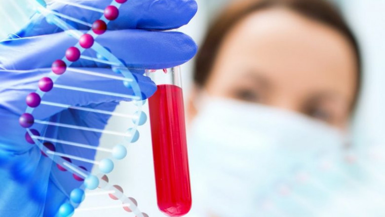 Anti-Obesity Therapeutics Market Research Report Detailed Analysis 2022| Research Informatic