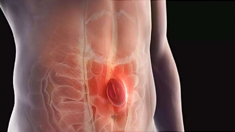 Applications of Hernia Repair Devices