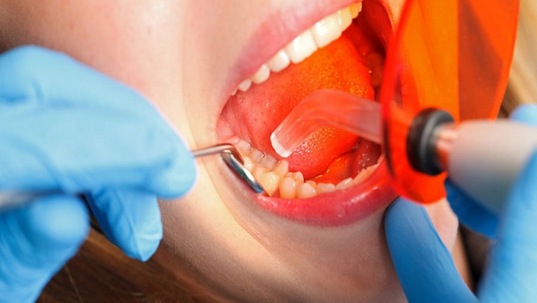 Why Are Dental Bridges A Vital Part Of Dentistry?