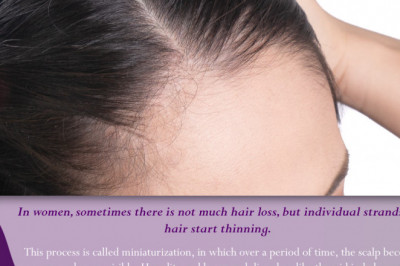What Are the Treatment Options Available for Women’s Hair Loss