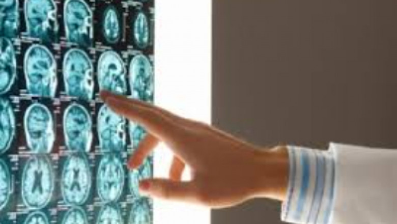 Diagnostic Imaging Market: Diagnostic Imaging To Grow at 5.5% CAGR During 2021-2028