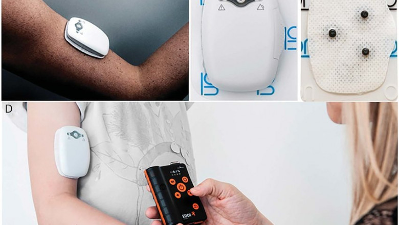 Epilepsy Monitoring Device Market Revenue Growth and Quantitative Analysis Till 2030