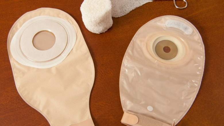 Global Colostomy Bags Market Key Developments
