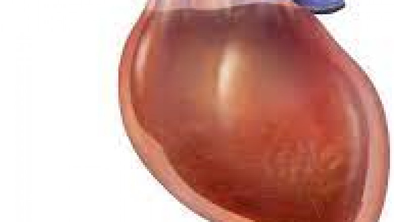 Global Pericardiocentesis Procedures Market 2022: COVID-19 Impact Analysis and Industry Forecast Report, 2028