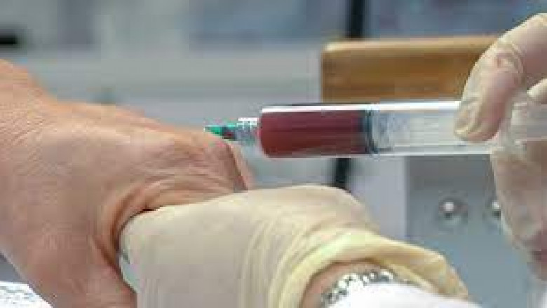 Global Platelet Rich Plasma Market 2022 - Top Key Players Analysis Report Till 2028