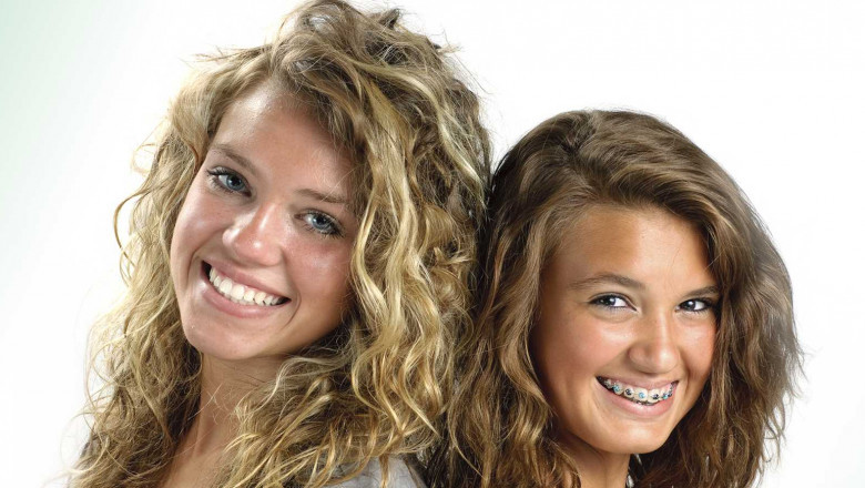 Obtain The Ideal Jawline With Invisalign