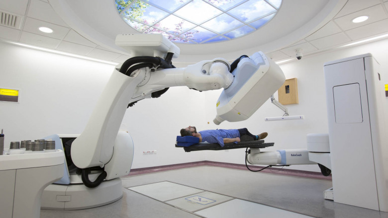 Non-Surgical Robotic Radiosurgery Using Cyberknife Is Used To Treat Tumors