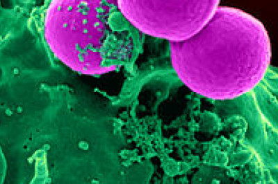 Global Methicillin Resistant Staphylococcus Aureus Treatment Market Current Trends and Future Aspect Analysis Report 2021–2028