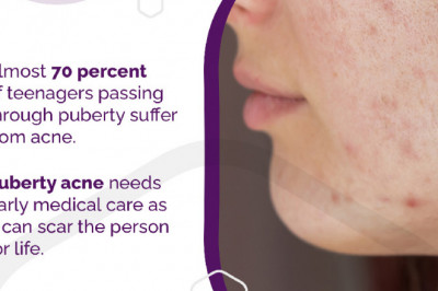 5 Reasons to See a Dermatologist for Acne Treatment